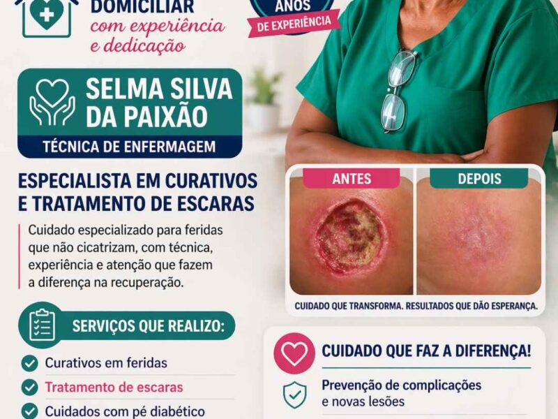 Tratamento de Feridas e Escaras em Altamira – Selma Silva